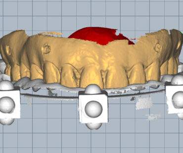 dima radiologica e stent